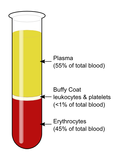 Základní separace krevních složek Transfuzní stanice Centrifugační rychlost 1500 2000 g (3000-3400 rpm) Základní složky Červené