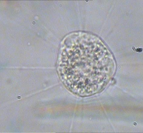 Actinophrys sol Biologické hodnocení charakteru aktivovaného kalu: Cenóza