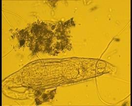 Rotaria Philodina Cephalodela Lepadella Biologické hodnocení charakteru aktivovaného kalu: Cenóza vířníků Indikace: stáří