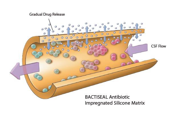 The solution Codman BACTISEAL TM EVD Catheter Impregnated with 2 Antibiotics: Rifampicin & Clindomycin Rifampicin gives the orange color Antibiotics diffuse from both inner and outer surface of the