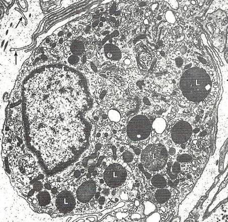 Lysosomy membránové váčky (ø = 0,05-0,5µm), obsahují cca 40 kyselých hydroláz, hojně obsažené v buňkách s endocytotickou a fagocytární aktivitou (b.