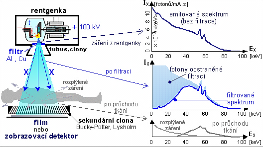 Obrázek č. 10: Energetické spektrum rentgenového záření po filtraci a po průchodu pacientem.