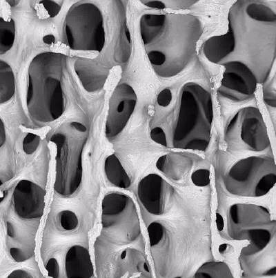 Trabekulární kost Spongiózní pletivo jemných trámců kosti - trabekula 20 % hmoty skeletu Základní funkce Metabolismus minerálů Síla a pružnost Vyšší míra kostního
