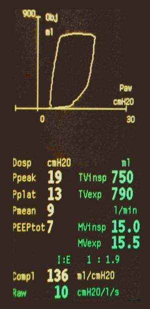 Spirometrie ET