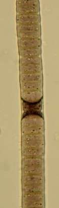 Brasilonema