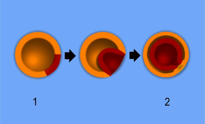 Embryogeneze - gastrula Gastrula: embryo má již různé vrstvy buněk = zárodečné listy (z nich se později