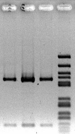 Metody molekulární biologie M M = DNA marker PCR produkt o velikosti 469
