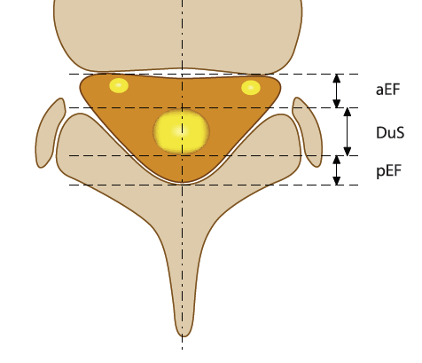 Diagnostika 1. Magnetická rezonance páteře 2.