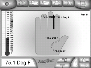 Teplotní mapa ruky aktivita v prostředí EZscreen. 1. Stiskněte tlačítko Mapa ruky (na obr. vlevo) 2. Umístěte sondu na zvolené místo na ruce a stiskněte START. 3.