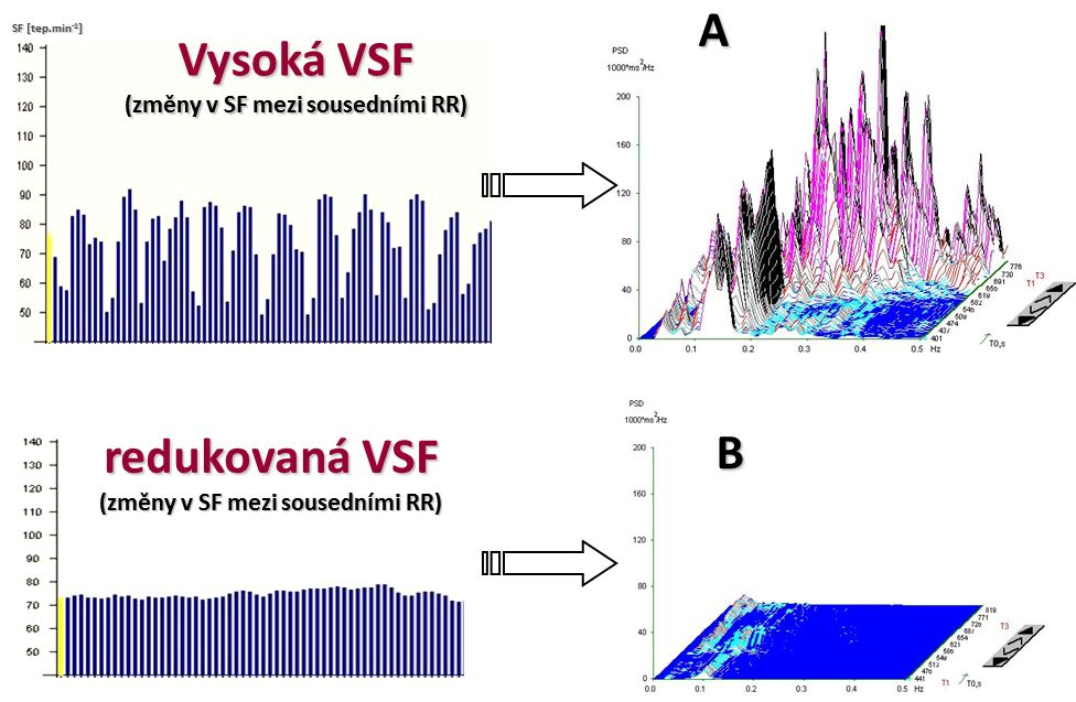 významnějšího regulačního vlivu vagu na srdeční rytmus během tělesné práce, odpovídá přibližně 45 % maximální tepové rezervy [6].