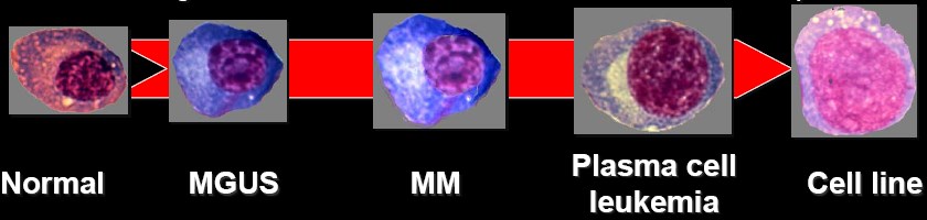 MM: Oncology perspective