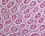 Kmenové buňky: Příloha D Může se tělo samo opravit?