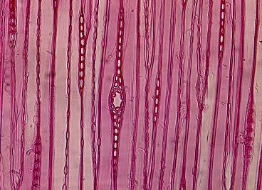 Buněčné stěny příčných tracheid jsou hladce zvlněné, typ teček v křížovém poli je piceoidní, jejich počet je 2-4-6. Počet parenchymatických buněk na výšku dřeňového paprsku je 10-15, maximálně 25.