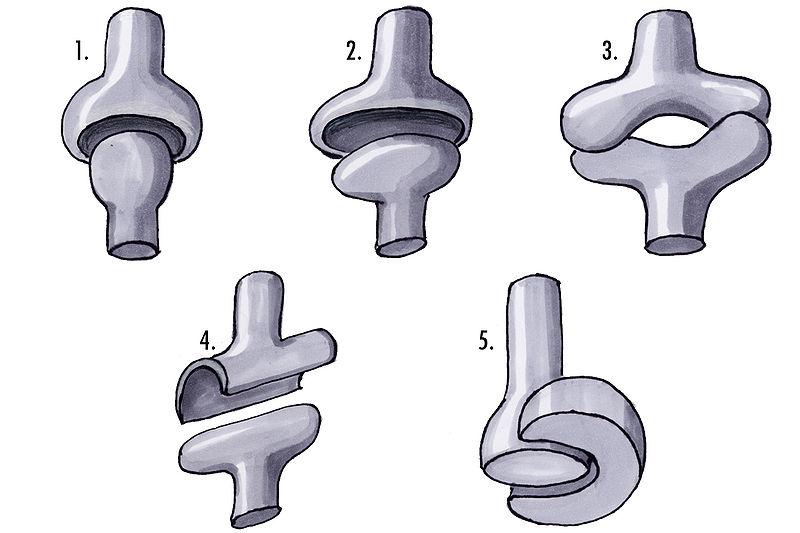 Druhy kloubů: 1. kulový kloub 2.elipsoidní kloub, 3.