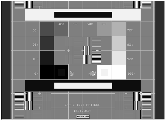ŘÍZENÍ KVALITY SNÍMKU 13 ŘÍZENÍ KVALITY SNÍMKU 13.1 Test kvality použitím testovacího obrazce SMPTE Ověřte kvalitu snímku po instalaci a před snímkováním pacienta.
