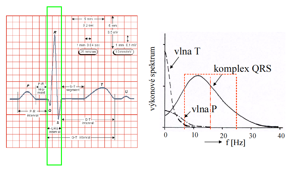 2.4 Zdroje rušení EKG Zajímavé pásmo EKG signálu bývá do 125 Hz Nejčastější tipy rušení ve snímaném signálů, převzato z [19] sítovým rušení 50Hz + vyšší harmonické složky kolísání nulové línie