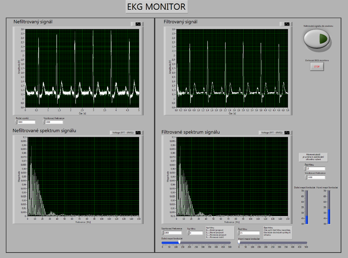 Obr.31 EKG monitor s defaultním nastavením 4.3 Bl