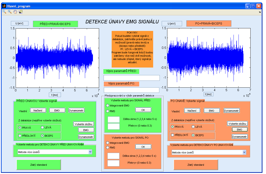 8 POPIS PROGRAMU Cílem diplomové práce je navrţení a realizace programu s uţivatelským rozhraním (GUI) v programovém prostředí Matlab.