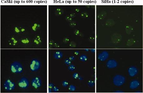 Detekce HPV + amplifikace genu hterc a MYCC buněk pomocí sondy Cervical FISH