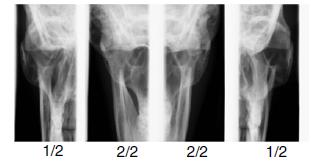 PROGRAMY Geometrie u přístroje se SCARA 2 je jiná. Dvojitý PA TMJ program Posterior-anterior snímkování otevřených a zavřených TMJ kloubů.