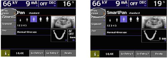 OVLÁDACÍ PANEL 8.4 Výběr temporomandibulárního expozičního programu Pokud chcete zvolit program pro snímkování temporomandibulárního kloubu (TMJ), klepněte nejprve na pole Prog na hlavní obrazovce.