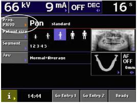 8.6 Výběr tomografického/transtomografického expozičního programu OVLÁDACÍ PANEL Tomo/transtomo jsou volitelné programy pro přístroje se SCARA3 a senzorem Dimax.
