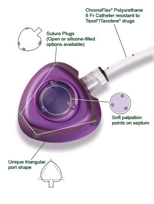 Indikace k implantaci portu -dlouhá plánovaná léčba ( měsíce a roky) -příznivé koagulační parametry -lepší performance