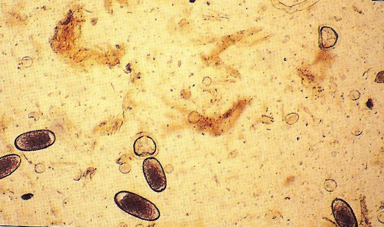 tasemnice je přitom vysoká, neměla by se patogenita tasemnic podceňovat (Mair, Divers, 1997). Obrázek 1: Anoplocephala perfoliata a Strongylidae (Mair, Divers, 1997) 3.2.