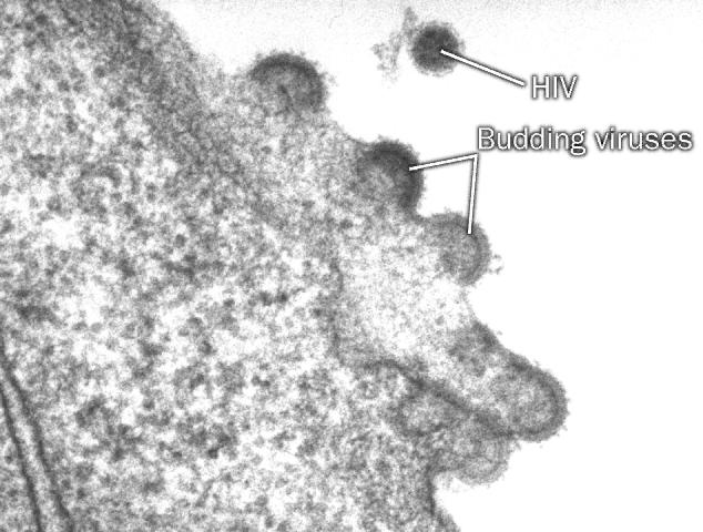 VIRY - INFEKCE Zrání Tvoří se kapsida