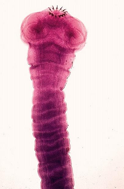 Taenia solium (tasemnice dlouhočlenná) onemocnění: rozšíření: životní cyklus: mezihostitel: definitivní host.
