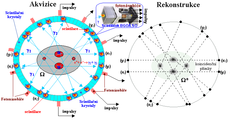 Obr. 5.2: PET scan. Zdroj [11] Další metodu elektronické kolimace používané pro gama záření představují tzv. Comptonovy kamery.