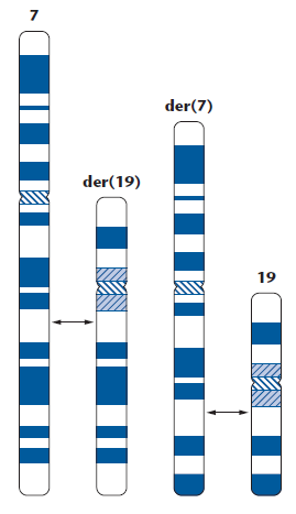 Změny ve struktuře chromosomů - mezi nehomologními chromosomy výměna části chromosomů bez ztráty materiálu = reciproká / balancovaná translokace - většina rodinně specifická, i když