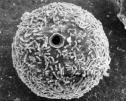 Porifera pohlavní rozmnožování - larva: PARENCHYMULA a TRICHIMELA