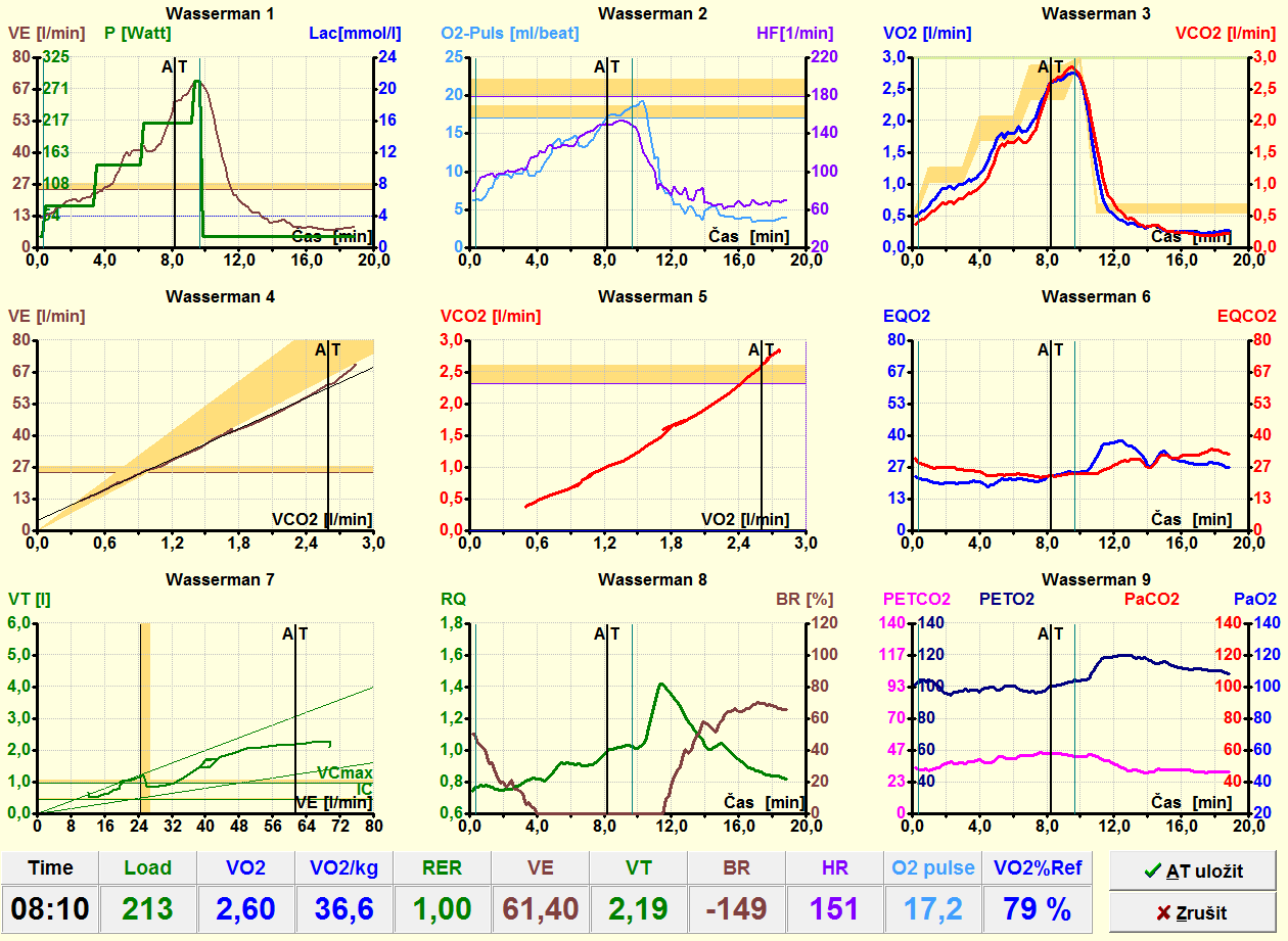 Pro úplnost uvádím i ukázky z programu LF8, který poskytuje spirometrické údaje. Na obrázku 24 je záznam ze samotného průběhu měření, na obrázku 25 tzv.