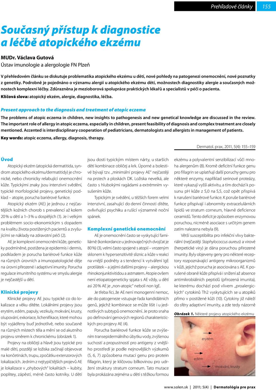 Podrobně je pojednáno o významu alergií u atopického ekzému dětí, možnostech diagnostiky alergie a současných možnostech komplexní léčby.