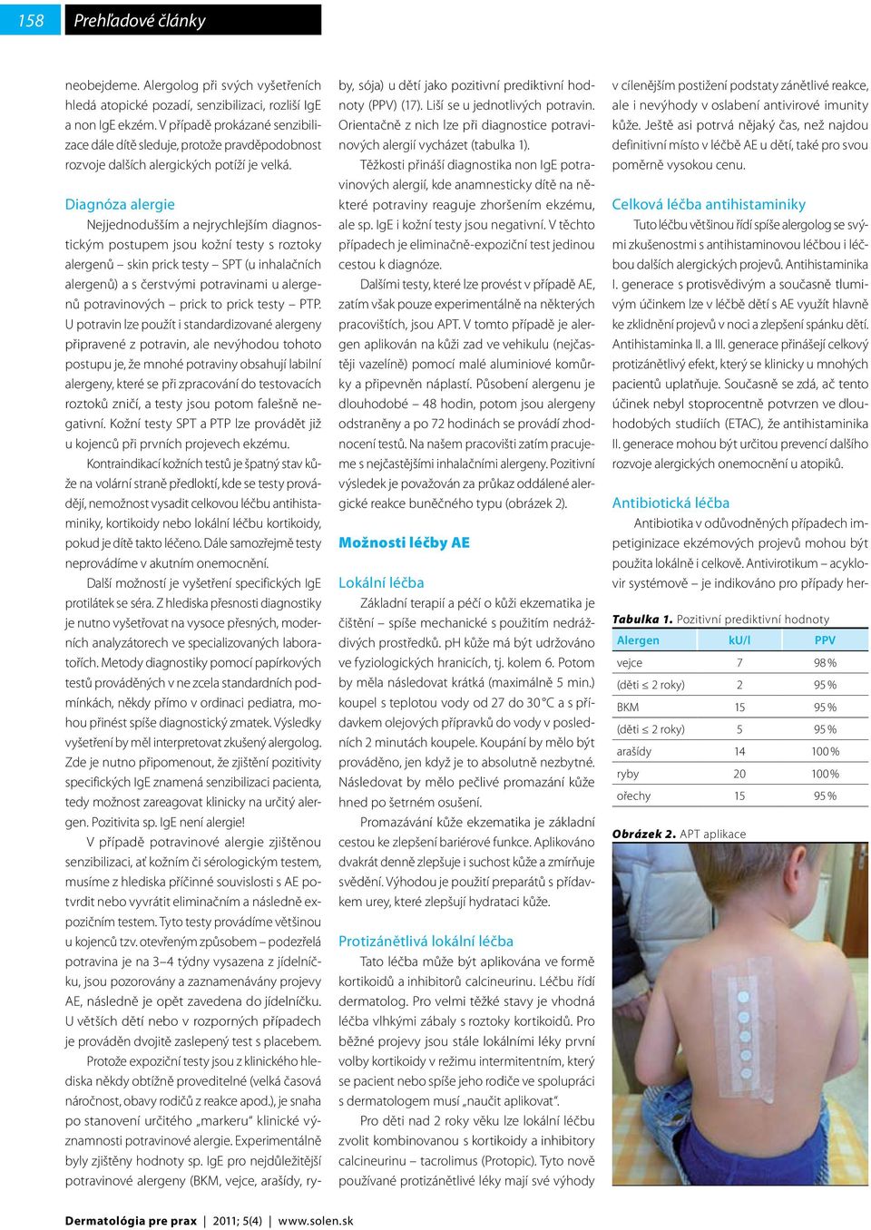 Diagnóza alergie Nejjednodušším a nejrychlejším diagnostickým postupem jsou kožní testy s roztoky alergenů skin prick testy SPT (u inhalačních alergenů) a s čerstvými potravinami u alergenů