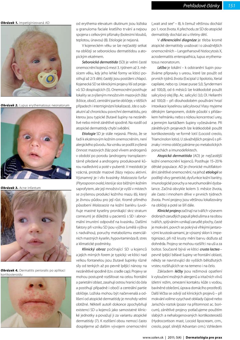 únavou) (8). Etiologie je nejasná. V kojeneckém věku se lze nejčastěji setkat na obličeji se seboroickou dermatitidou a atopickým ekzémem.