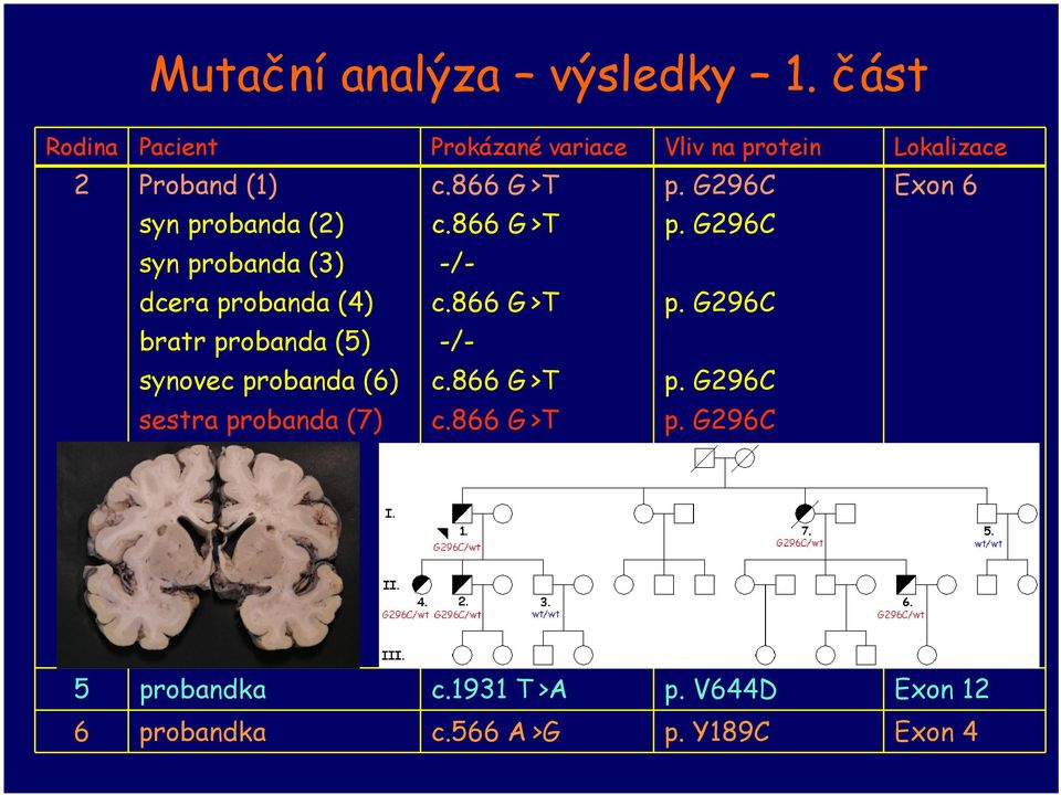 G296C Exon 6 syn probanda (2) c.866 G >T p. G296C syn probanda (3) -/- dcera probanda (4) c.866 G >T p. G296C bratr probanda (5) -/- synovec probanda (6) c.