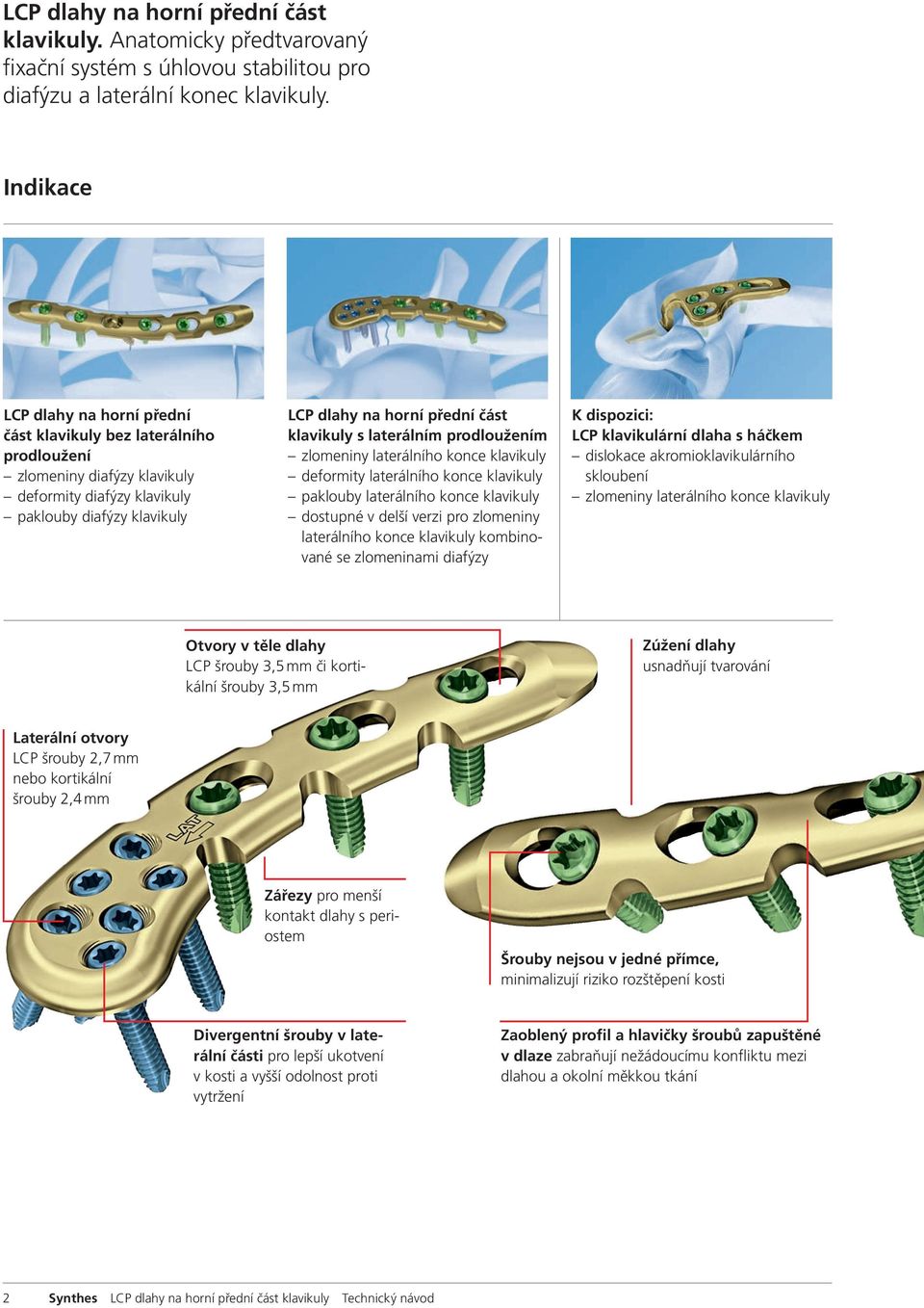 klavikuly s laterálním prodloužením zlomeniny laterálního konce klavikuly deformity laterálního konce klavikuly paklouby laterálního konce klavikuly dostupné v delší verzi pro zlomeniny laterálního