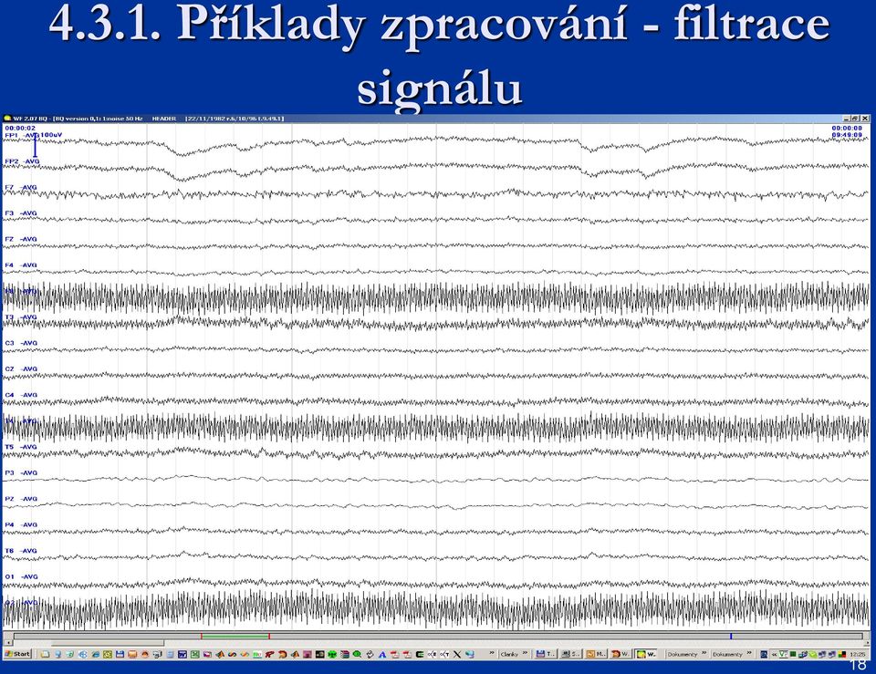 zpracování