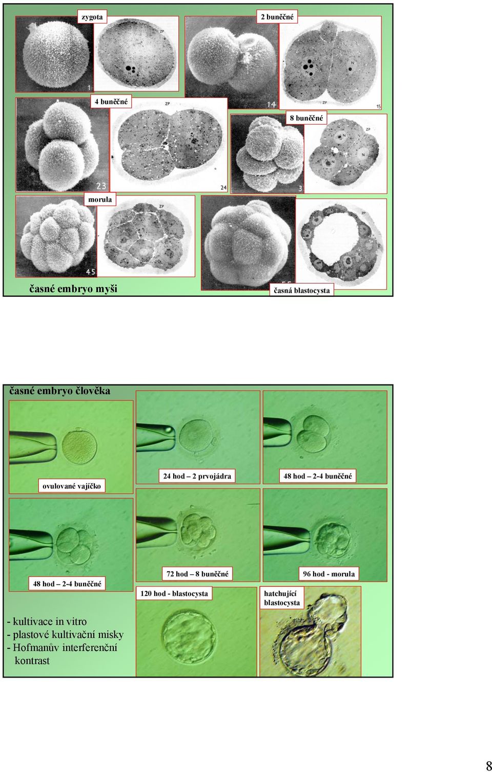 2-4 buněčné - kultivace in vitro - plastové kultivační misky -Hofmanův interferenční