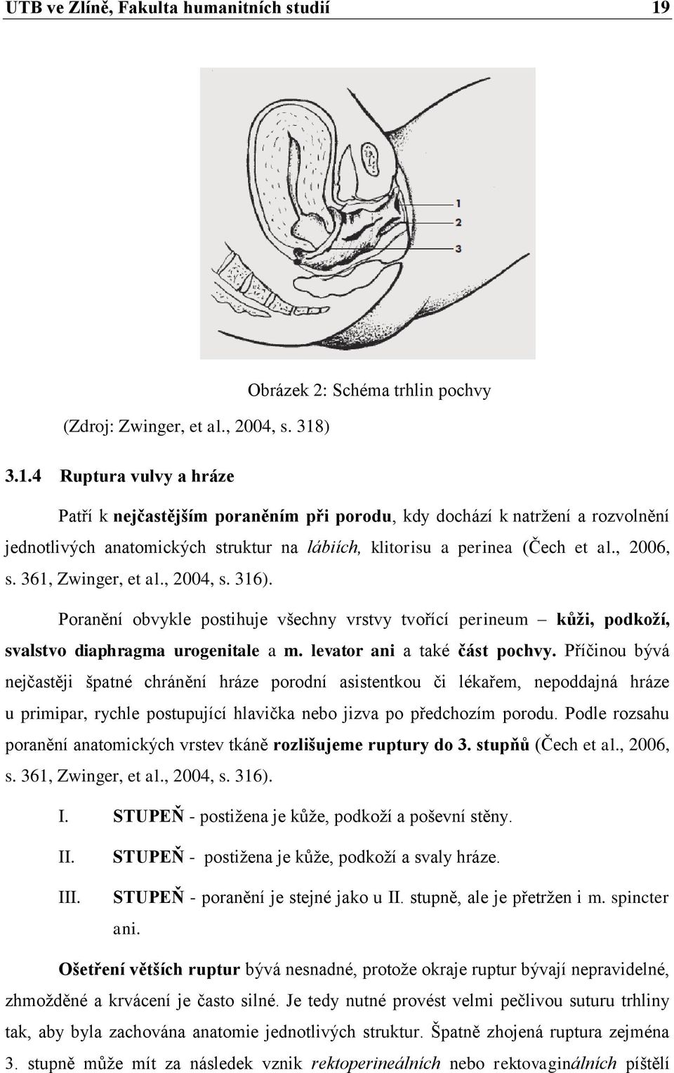 ) Obrázek 2: Schéma trhlin pochvy 3.1.