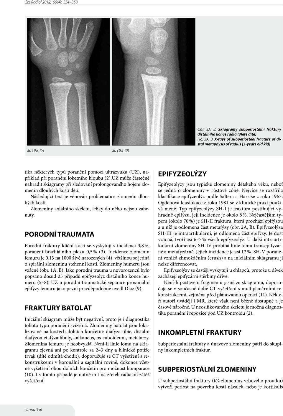 X-rays of subperiosteal fracture of distal metaphysis of radius (3-years old kid) tika některých typů poranění pomocí ultrazvuku (UZ), například při poranění loketního kloubu (2).