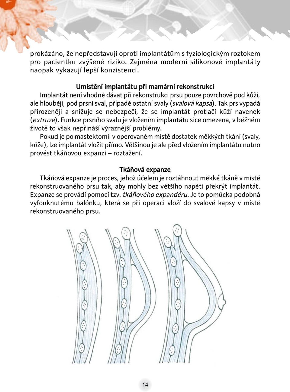Tak prs vypadá přirozeněji a snižuje se nebezpečí, že se implantát protlačí kůží navenek (extruze).