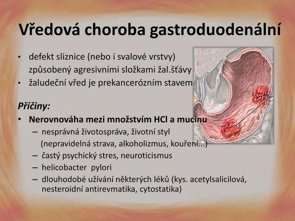 životospráva, životní styl (nepravidelná strava, alkoholizmus, kouření.