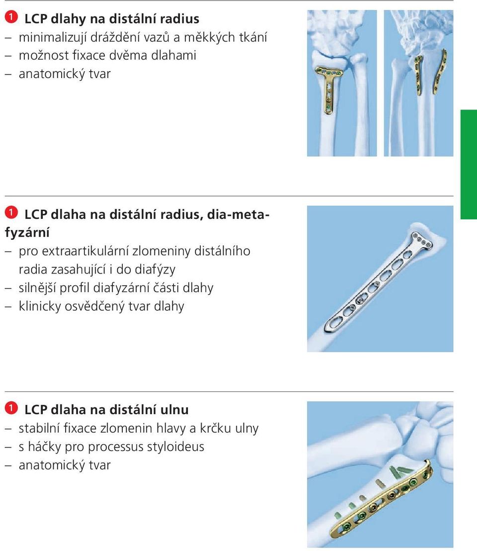 radia zasahující i do diafýzy silnější profil diafyzární části dlahy klinicky osvědčený tvar dlahy LCP