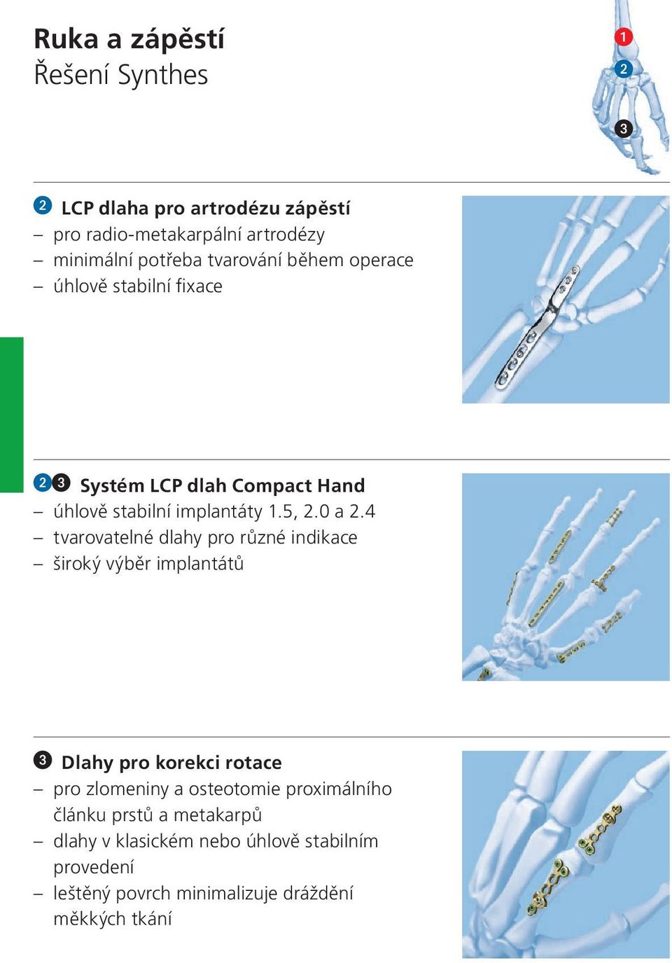 4 tvarovatelné dlahy pro různé indikace široký výběr implantátů Dlahy pro korekci rotace pro zlomeniny a osteotomie