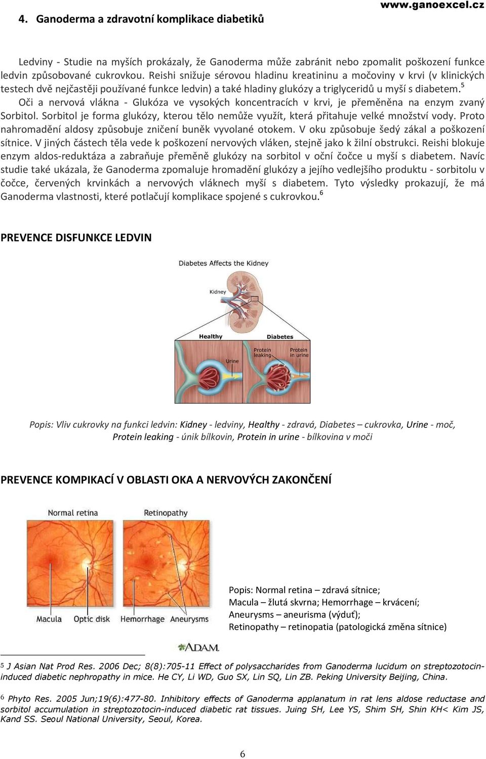 5 Oči a nervová vlákna - Glukóza ve vysokých koncentracích v krvi, je přeměněna na enzym zvaný Sorbitol. Sorbitol je forma glukózy, kterou tělo nemůže využít, která přitahuje velké množství vody.