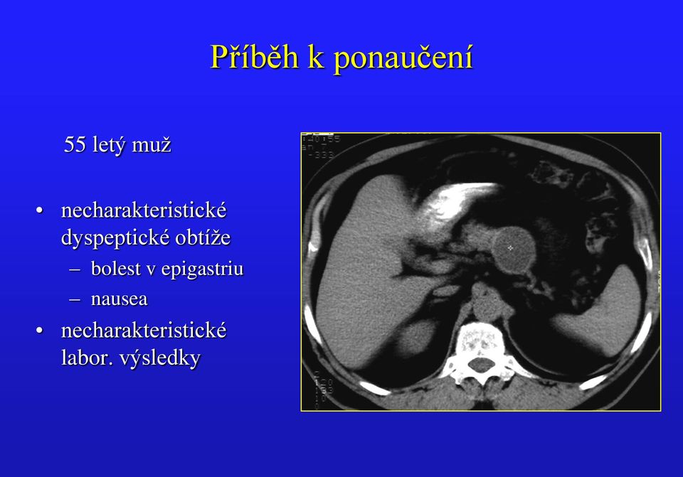 obtíže bolest v epigastriu