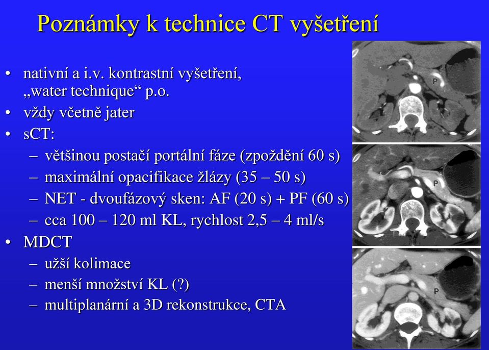 opacifikace žlázy (35 50 s) NET - dvoufázový sken: AF (20 s) + PF (60 s) cca 100 120 ml